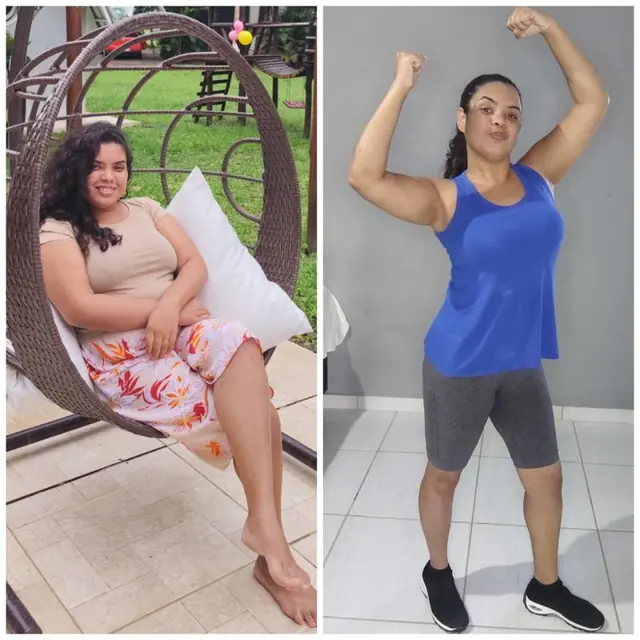 Antes e depois da Vanessa