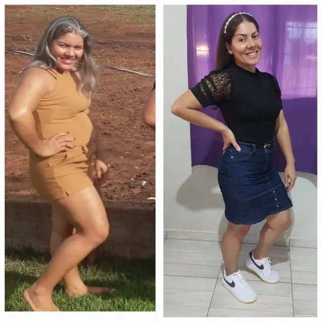 Antes e depois da Suely